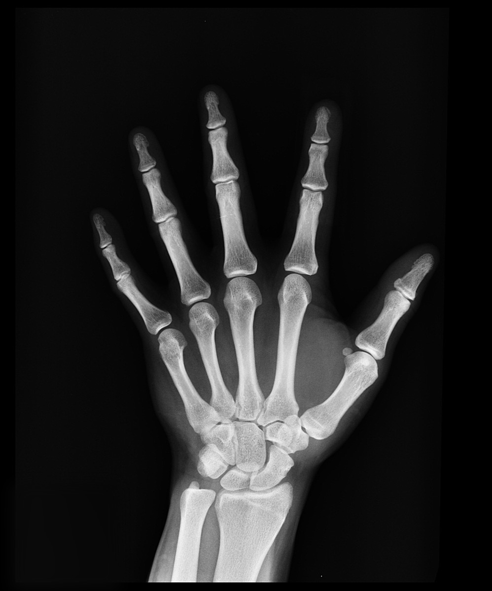 Hand & Handgelenk