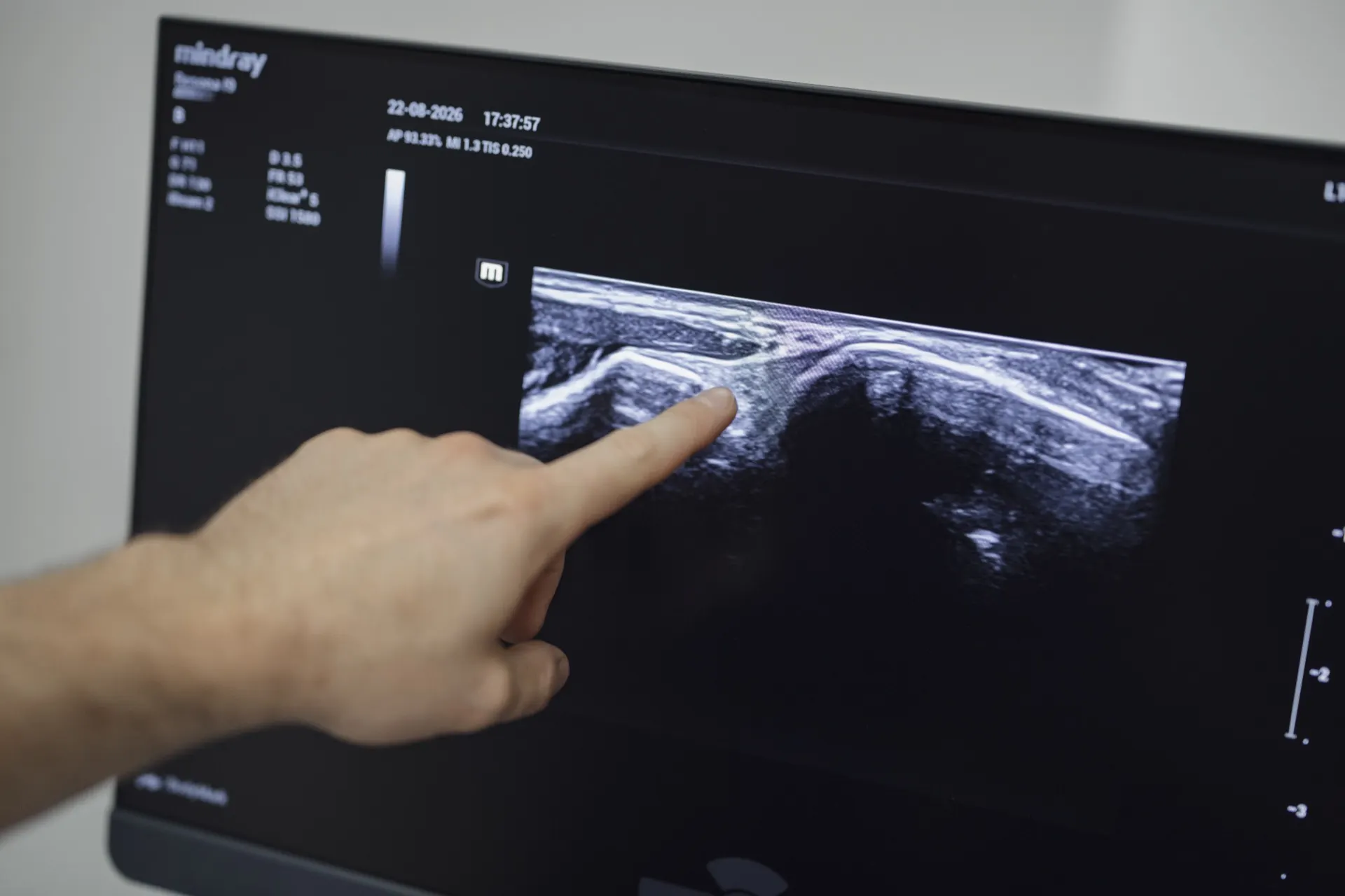 MSK Ultraschall bei werkeins